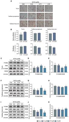 Sodium acetate regulates <mark class="highlighted">milk fat</mark> synthesis through the activation of GPR41/GPR43 signaling pathway